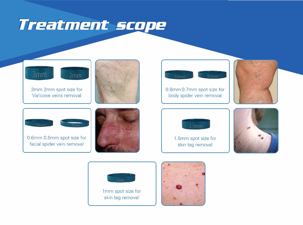 Immediate-result-OEM-ODM-8-different-spot (3).jpg