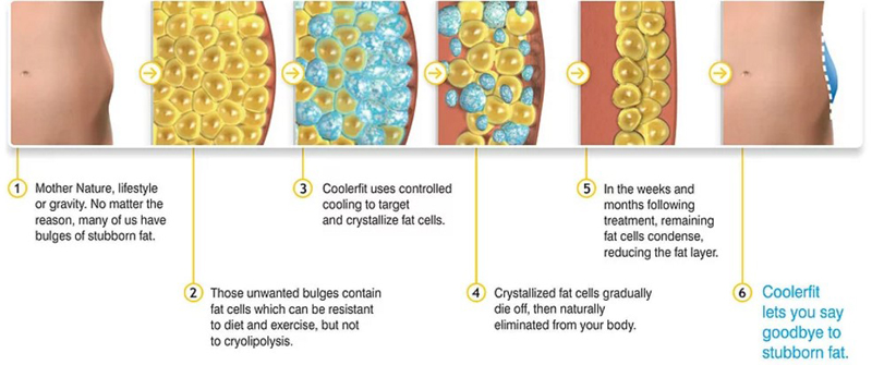 Nonsurgical Fat Reduction Dual Cryo Heads Cryo Cryolipolysis Freezing Fat Body slimming Machine